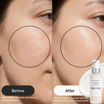Before and after comparison of skin with Refine Beauty Aloe & Avocado moisturizer 