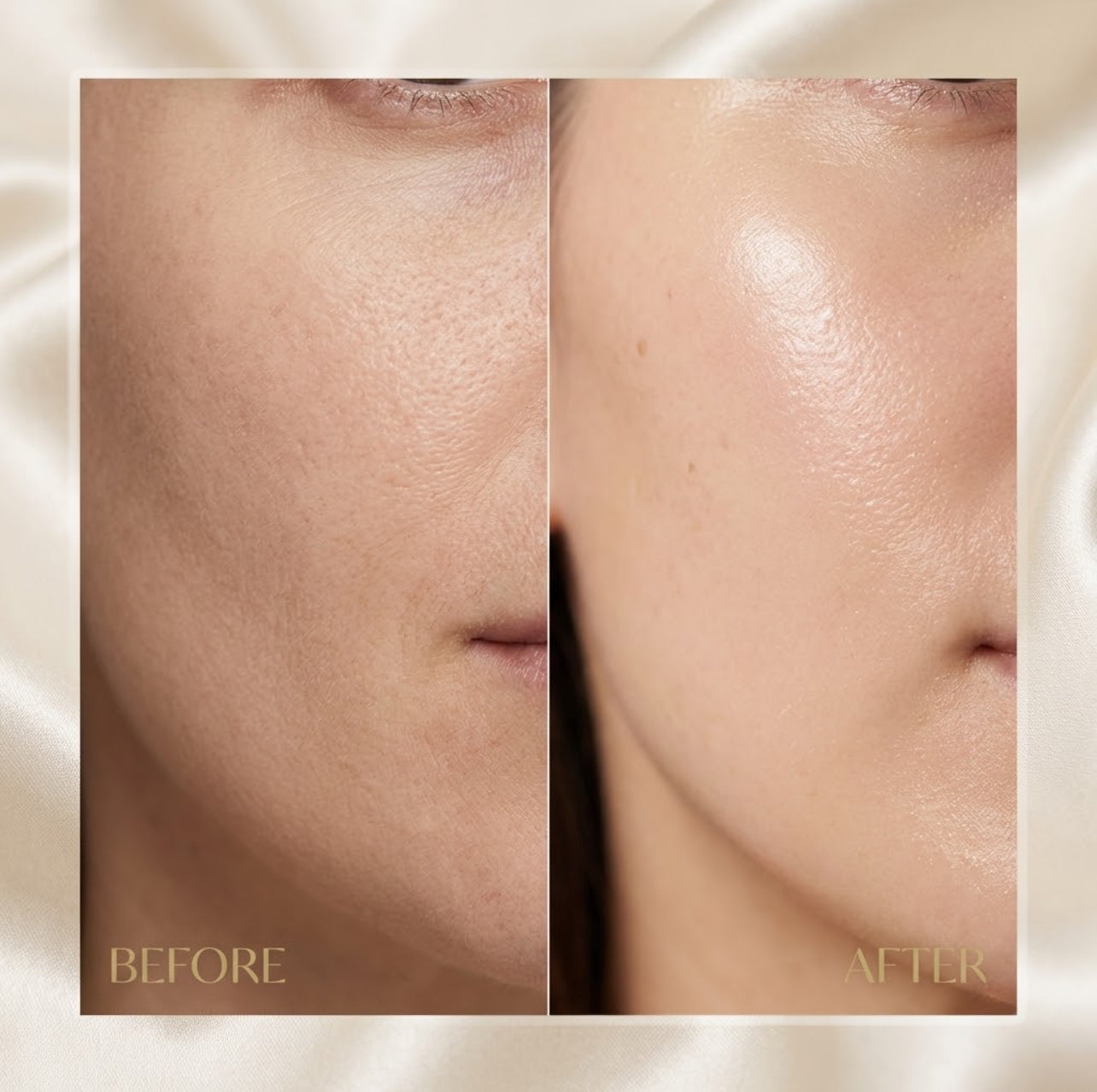 Before and after comparison of skin texture on a neutral background after using Refine Beauty Aloe & Avocado Moisturizer