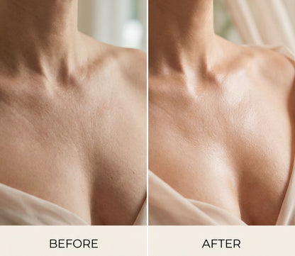 Before and after comparison of skin texture on a person's shoulder upon using Refine Beauty The FIRM Body Cream 